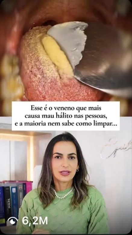 Vídeo de aluna sobre mau hálito com 6,2 milhões de visualizações