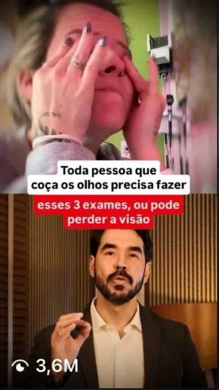 Vídeo de oftalmologista sobre coçar os olhos com 3,6 milhões de visualizações