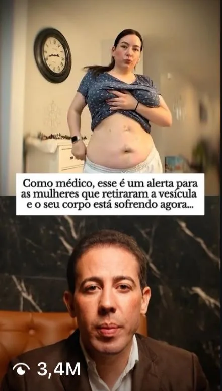 Vídeo de médico sobre retirada da vesícula com 3,4 milhões de visualizações